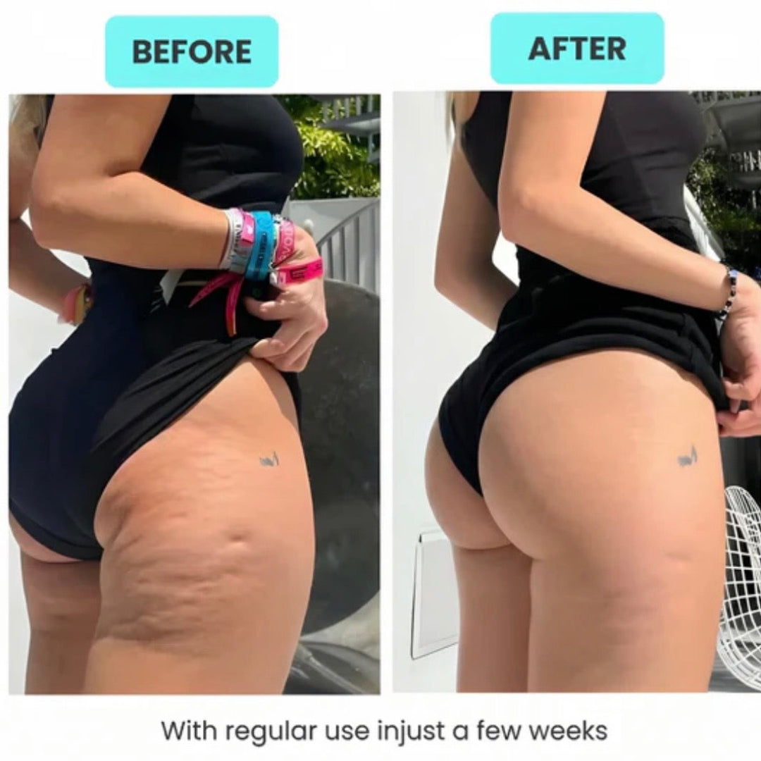 Smooth & Tone Stubborn Areas At Home