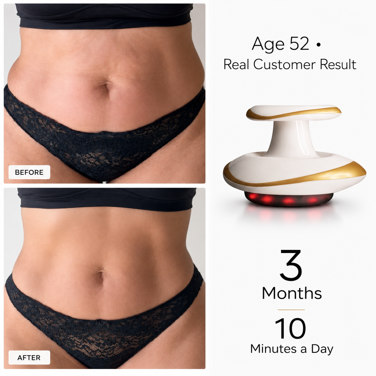 Smooth & Firm Stubborn Areas At Home