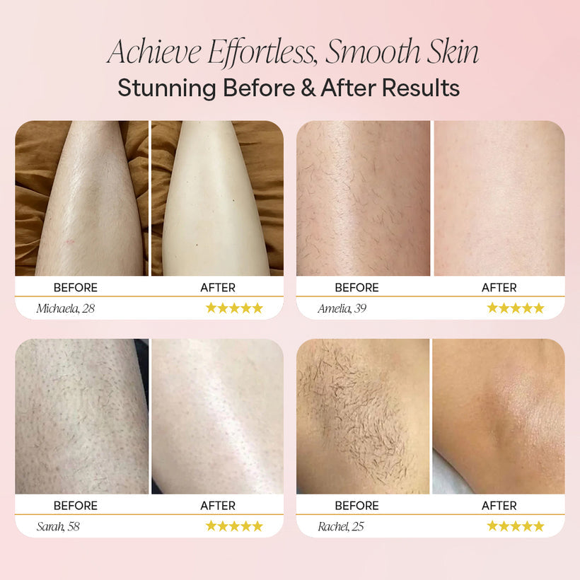 Dermelle™ Precision  Pro